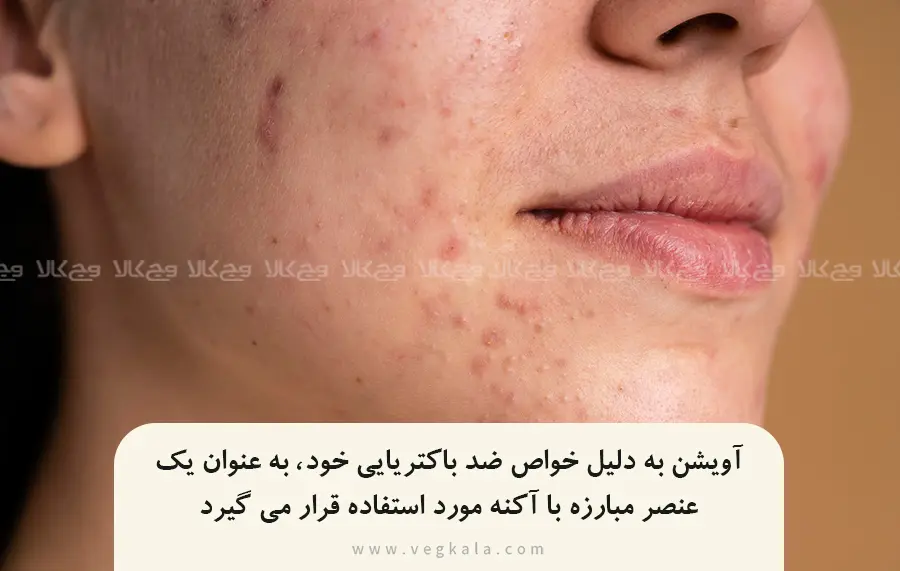 خواص آویشن در رفع آکنه