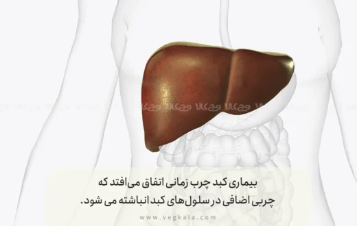 بیماری کبد چرب چیست؟