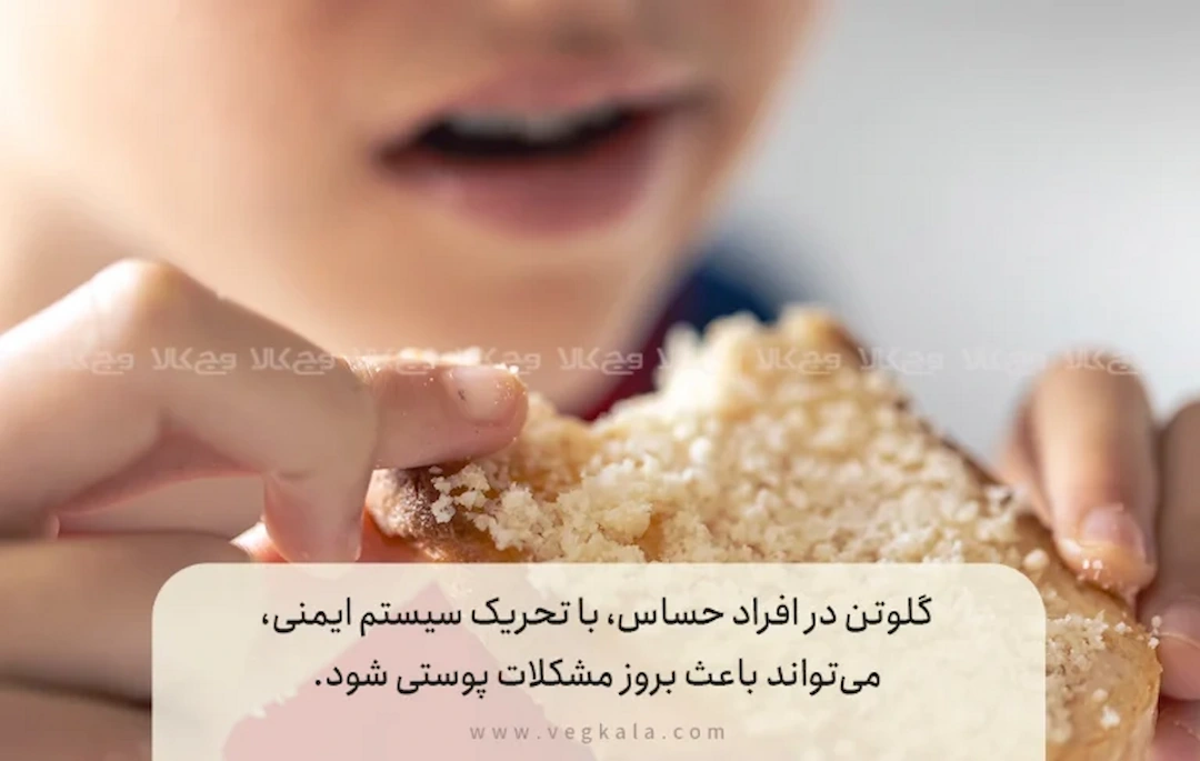 ۳. ارتباط عمیق بین گلوتن، سیستم ایمنی و پوست