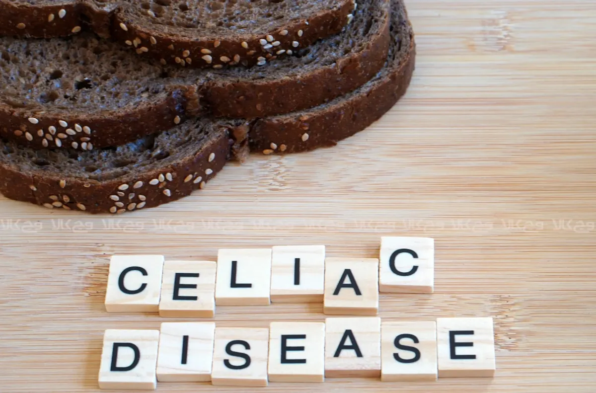 تشخیص بیماری سلیاک راهنمای جامع از علائم تا درمان
